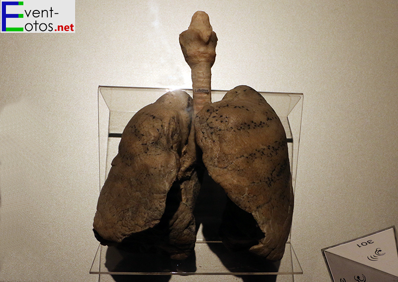 Die menschliche Lunge
