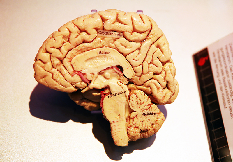Querschnitt durch das menschliche Gehirn

